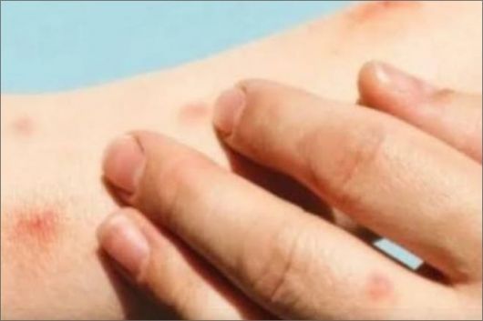 Foto: Divulgação / Instagran